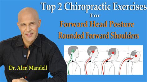 Top 2 Chiropractic Exercises For Forward Head Posture And Rounded