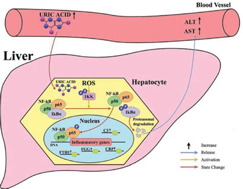 Sex Specific Association Between Serum Uric Acid And Elevated Alanine Aminotransferase In A