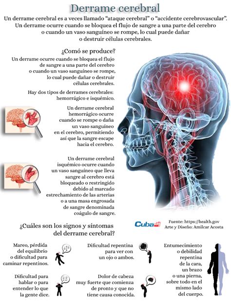 Cómo detectar que alguien sufre un posible derrame cerebral infografía