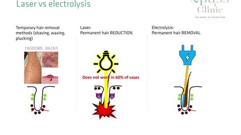 electrolysis vs laser hair removal reddit - gilroy-roegner-99