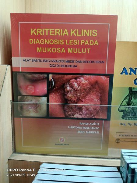 Jual Buku ORI Buku KRITERIA KLINIS DIAGNOSIS LESI PADA MUKOSA MULUT