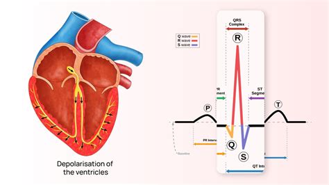 Qrs Complex Abnormalities Clarifying Ecg Abnormalities For Heart Health