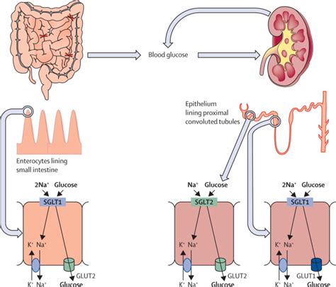 Sglt Inhibitors In Management Of Diabetes The Lancet Diabetes