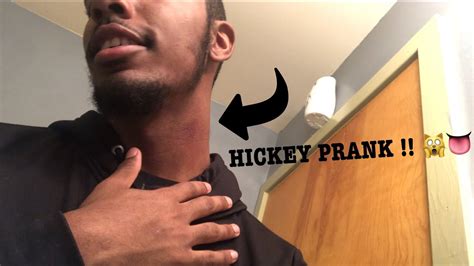 Hickey Prank On Girlfriend She Put Her Hands On Me Youtube