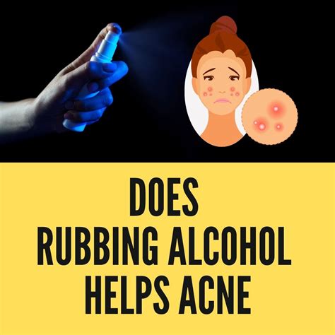 rubbing alcohol  acne  methods