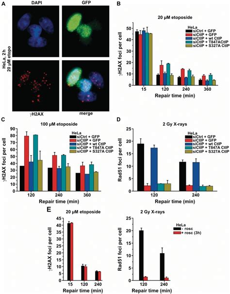 CtIP Function During Repair Of Etoposide Induced DSBs In G1 Requires