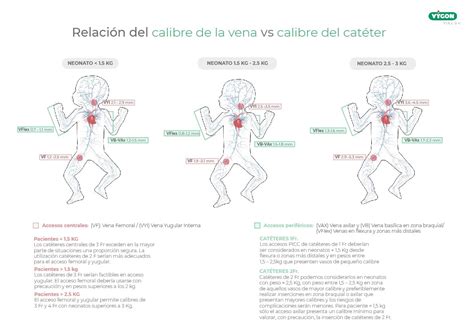 Ventajas Del Uso De La Ecograf A Aplicada A La T Cnica Microseldinger