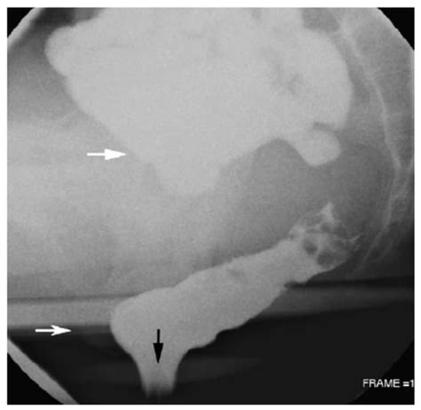 J Imaging Free Full Text Imaging Of Gastrointestinal Tract Ailments