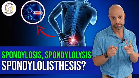 Whats The Difference Between Spondylosis Spondylolysis And