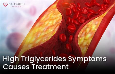 High Triglycerides Levels Normal Range Symptoms Causes And Treatment