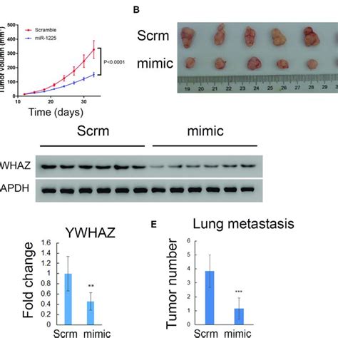 Hsa Mir P Inhibited Osteosarcoma Tumor Growth And Lung Metastasis