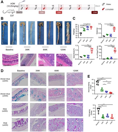 The CircRNA Expression Profile Of Colorectal Inflammatory Cancer