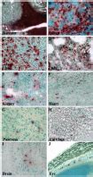 Widespread Tissue Distribution Of Transplanted Human ALDH Hi Lin