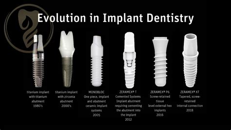 Ceramic Implants Are An Emerging Opportunity And Now Is The Time