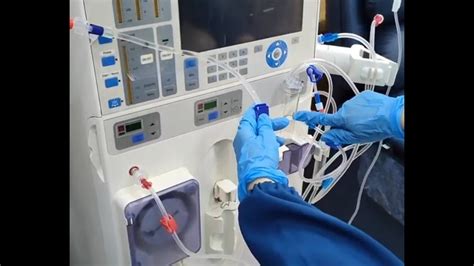 How To Start A Dialysis Machine Eco Priming Fresenius S Youtube