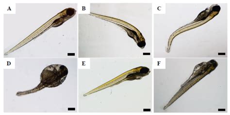 Malformations Found In Exposed Zebrafish Embryos At 120 Hpf A