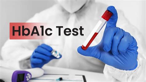 Hba1c Test Overview Significance Test Range Preparation Genu Path Labs