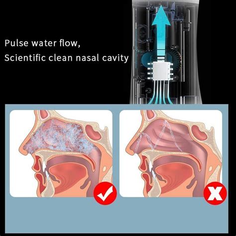 Electric Cordless Nasal Irrigation System With 30 Saline PacketsNasal