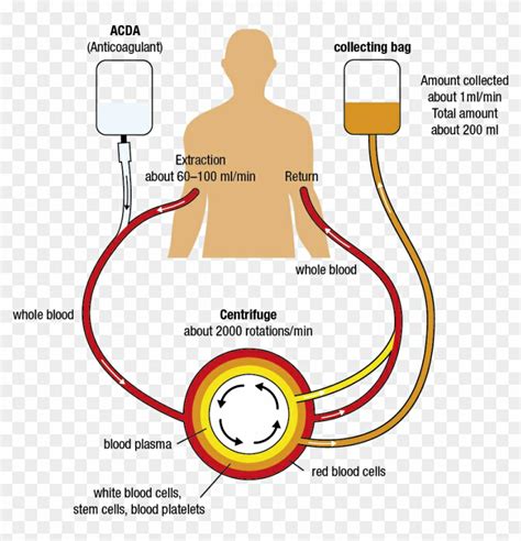 Private Musings Of A Philanthrope My First Wbc Apheresis In Nh