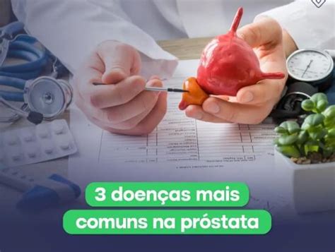 Doen As Mais Comuns Na Pr Stata Instituto De Urologia Urologia Em