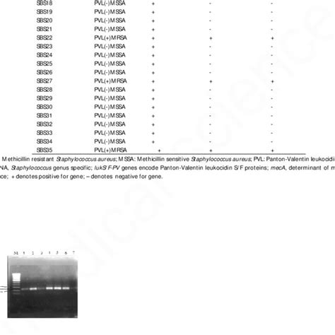 Agarose Gel Electrophoresis Of Pcr Amplified Products On 1 Agarose Gel