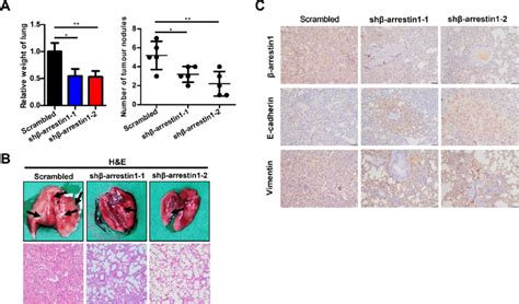 Arrestin Promotes Gc Metastasis In Vivo A The Weight Of Lung And