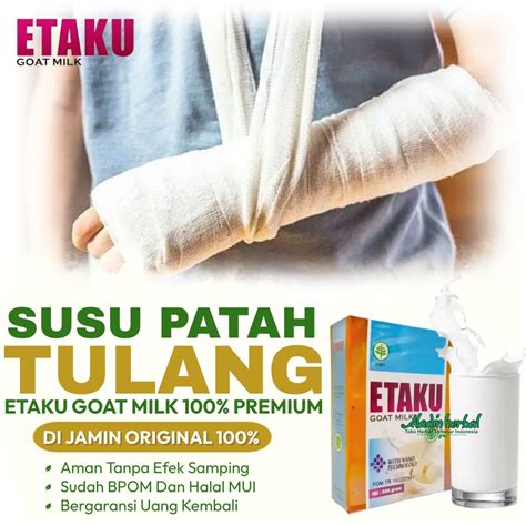 Jual Susu Patah Tulang Anak Dan Dewasa Obat Patah Tulang Pada Tangan