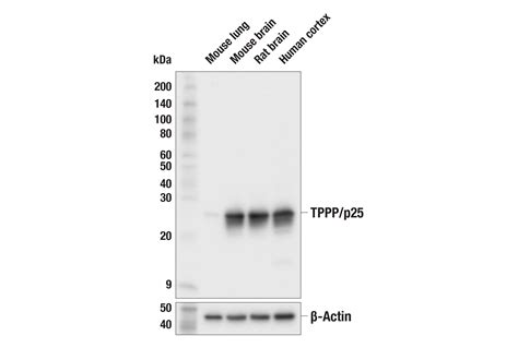 Tppp P E F S Rabbit Mab Cell Signaling Technology