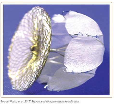 Figure 3 Transcatheter Left Atrial Appendage Closure Device The