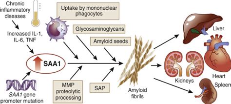 Aa Amyloidosis Without Systemic Inflammation When Clinical Evidence Validates Predictions Of