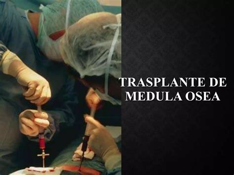 Transplante De Medula Osea PPT