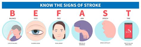 stroke symptoms types treatment navigating healthcare
