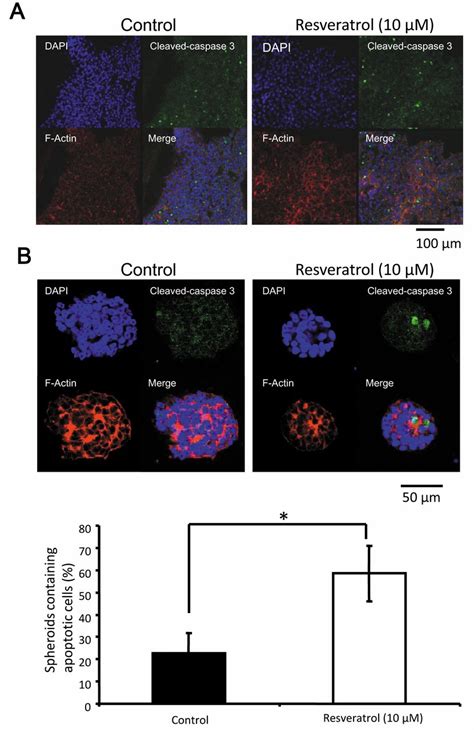 Resveratrol Induces Luminal Apoptosis Of Human Colorectal Cancer Hct116 Cells In Three