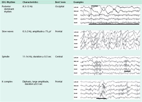 Stages Of Sleep EEG