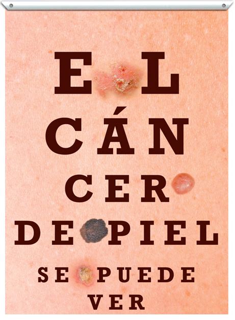 El Día Del Melanoma Se Celebra Bajo El Lema ‘el Cáncer De Piel Se Puede