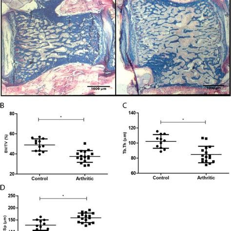 Bone Turnover Markers Quantification In Control N 9 And Arthritic Download Scientific