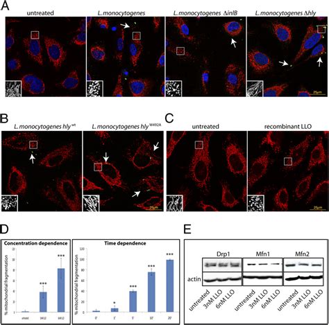 LLO Induces Mitochondrial Fragmentation Without Affecting Total Levels