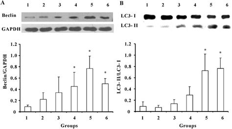 Ischemic Preconditioning Ipc Activates Autophagy In Rats Undergoing