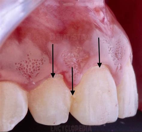 latest posts dentistry encyclopedia