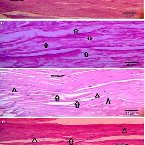 A Effect Of Eestf On Il In Cci Induced Neuropathic Pain Values Are