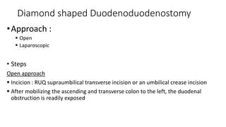 Duodenal atresia | PPT