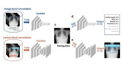 Radiology Artificial Intelligence On Twitter Fine Grained Chest Xray