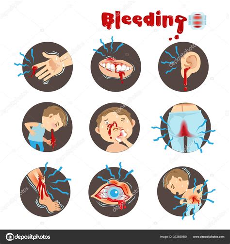 Bleeding Medical Vector Illustration Stock Vector by ©ann131313 372859854