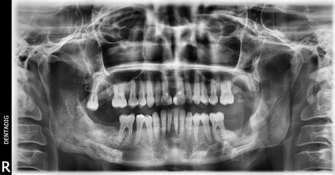 Periodoncia Realsmalto