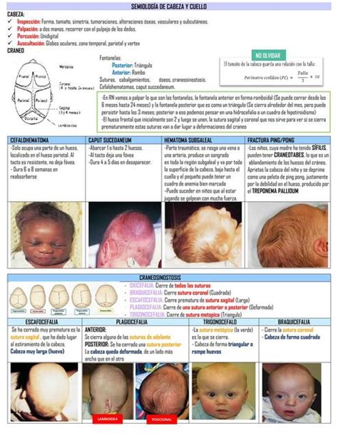 Semiologia De Cabeza Y Cuello Pediatrica Lesly Arela Udocz