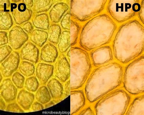 Onion Cells Under Microscope Lpo