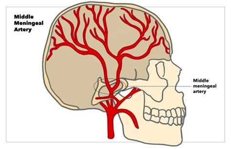 Figure Middle Meningeal Artery Illustration By Emma Gregory