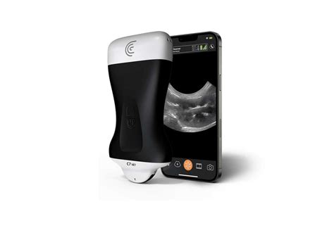 Clarius Portable Wireless Veterinary Ultrasound In Australia And New