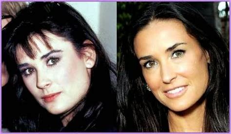 Demi Moore Admits Plastic Surgery Before And After Pictures Botox