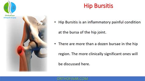 Trochanteric Bursitis Bút Chì Xanh